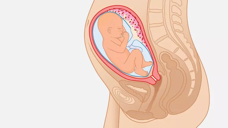 Тонус 34 неделя. Плод на 26 неделе беременности. Расположение плода на 26 неделе беременности. Малыш на 26 неделе беременности в животе. Расположение малыша в животе.