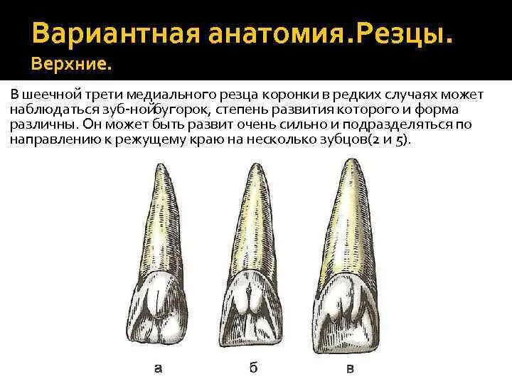 Латеральный верхний резец верхней челюсти. Центральный медиальный резец верхней челюсти. Медиальный резец верхней челюсти анатомия. Мезиальный резец верхней челюсти анатомия.