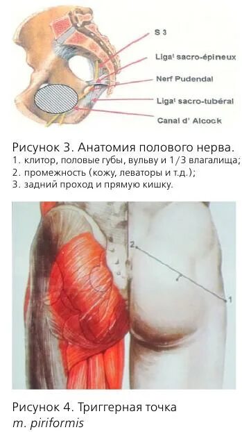 Половой нерв симптомы у женщин. Воспаление полового нерва. Невралгия полового нерва.