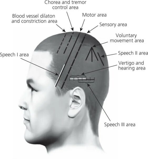 зоны краниопунктуры. скальп акупунктура. скальпотерапия зоны. какой автор предложил краниопунктуру скальптерапию. какой автор предложил краниопунктуру скальптерапию.