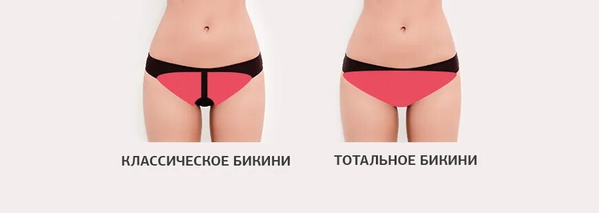 Чем отличается бикини от тотального бикини. Классическое и тотальное бикини. тотальное бикини и классическое бикини. зона классического бикини. эпиляция бикини классика.