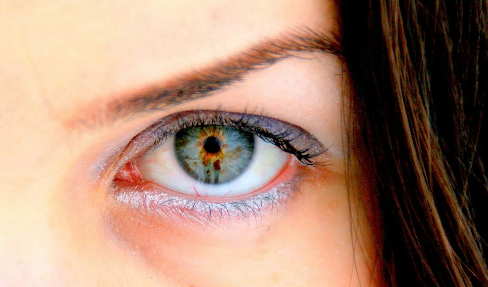 Вые глазах. Центральная гетерохромия карих глаз. Секторная гетерохромия глаза у человека. Центральная гетерохромия зеленый Карий. Центральная гетерохромия зрачок.