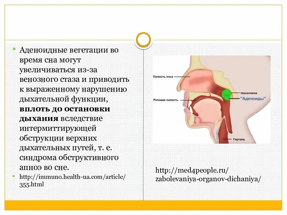 Аденоидные вегетации 1. Аденоиды строение и функции. Аденоидные вегетации степени.