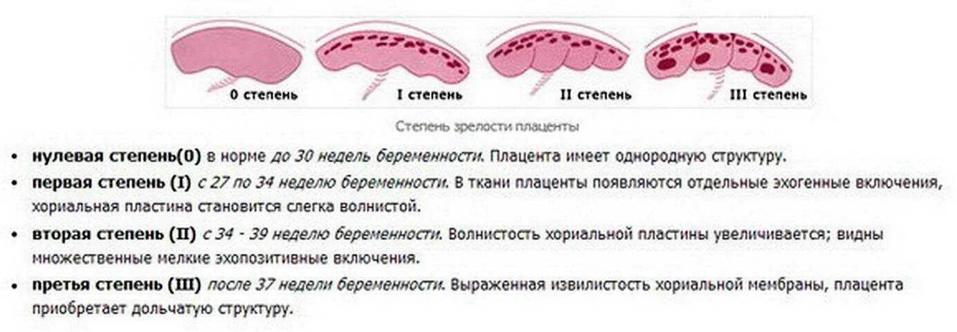 Плацента на какой неделе. Степень зрелости плаценты 1-2. Степень зрелости плаценты норма. Степени зрелости плаценты по УЗИ. Степень зрелости плаценты УЗИ.