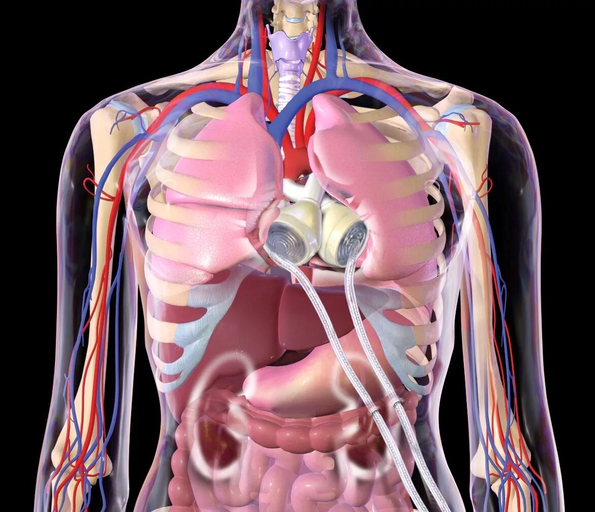 Искусственные внутренние органы. Искусственные органы сердце. Искусственное сердце человека.