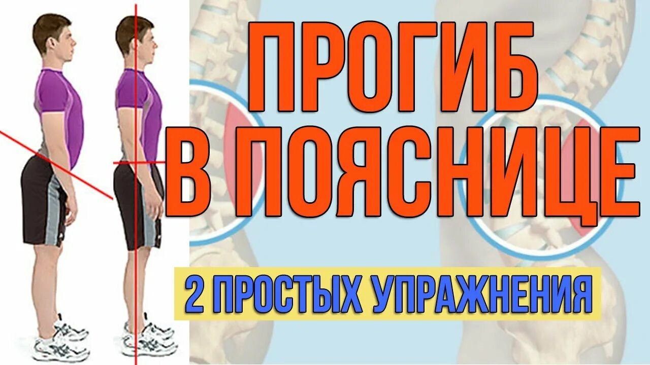 Прогиб в пояснице. Убрать прогиб в пояснице упражнения. Сильный изгиб в пояснице.