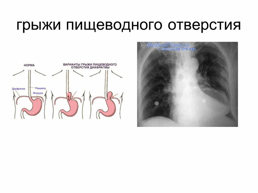 Что такое г п д. Что такое г п д