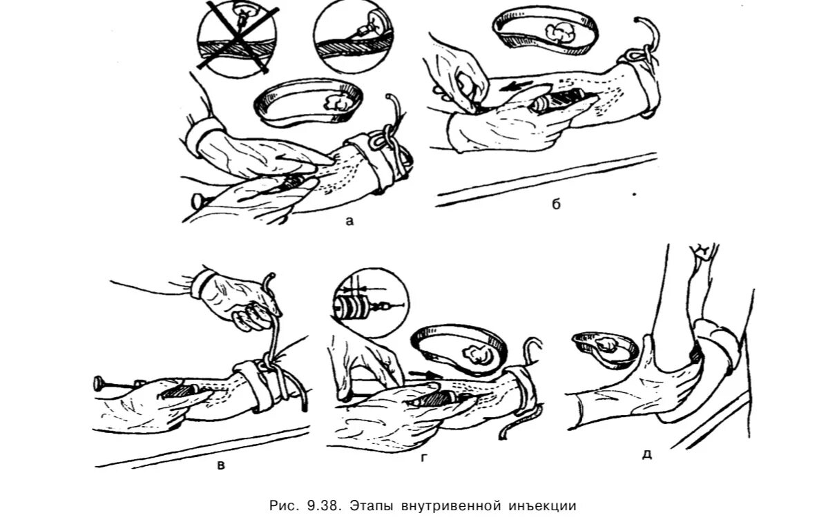 Введение инъекций алгоритм. Алгоритм проведения внутривенной инъекции. Внутривенная инъекция алгоритм выполнения. Постановка внутривенной инъекции алгоритм. Алгоритм ведения внутривенное Введение.