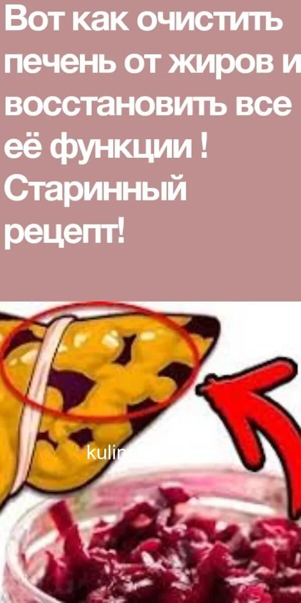 Восстановим печень народными средствами. Очищение и восстановление печени. Как очистить печень от жиров. Как и чем чистить печень.