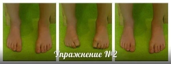 Эффективен ли массаж против вальгусной деформации стопы. Массаж для стоп при вальгусной деформации стопы у детей. вальгус плоскостопие упражнения. массаж при вальгусе стоп у детей. гимнастика для стоп при вальгусной деформации у детей.