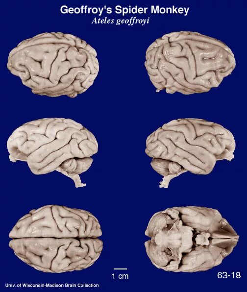 Re brain