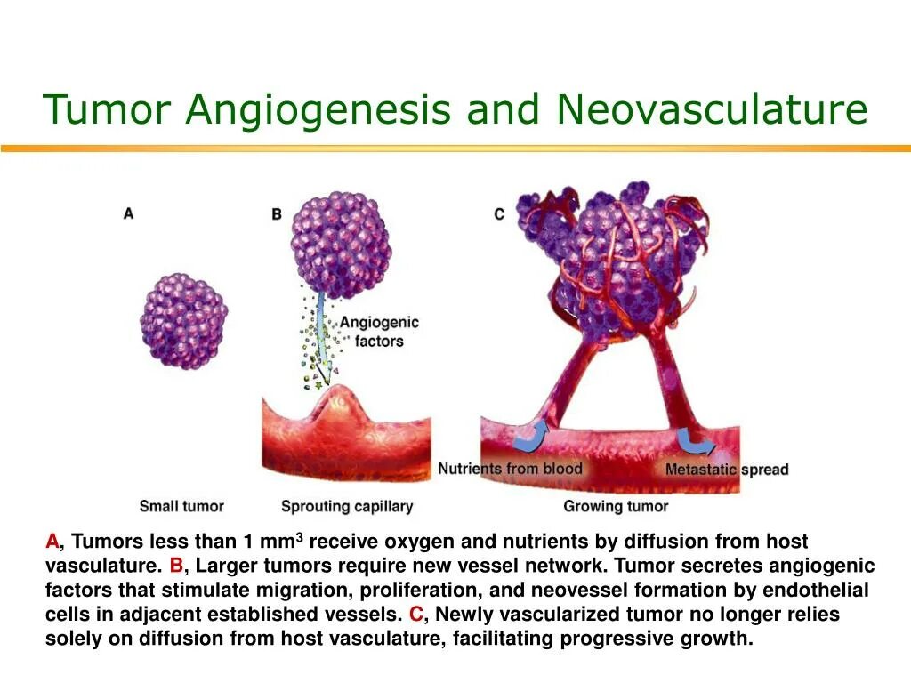 Advanced tumor
