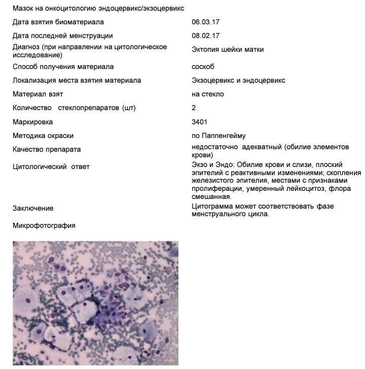 Мазок эндоцервикса. Расшифровка анализа цитологического исследования мазка. Цитологическое исследование мазка с шейки матки расшифровка. Цитологическое исследование микропрепарата шейки матки nilm. Цитологическое исследование соскоба с шейки матки.