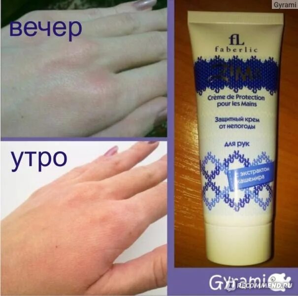 Крем от холодовой аллергии на лице. Мазь от холодовой аллергии на руках. Аллергия на холод крем для рук