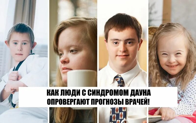 Дети людей с синдромом дауна