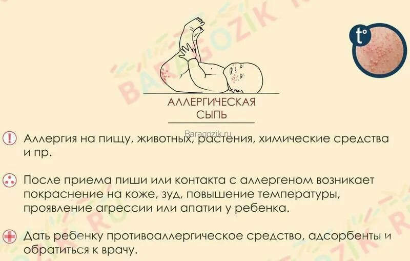 У грудничка сыпь на спинке - Вопрос дерматологу - 03 Онлайн