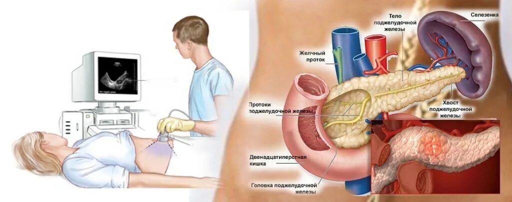 Узи полные органов. Трансабдоминальное УЗИ хронический панкреатит. Ультразвуковое исследование поджелудочной железы. УЗИ поджелудочной железы панкреатит. УЗИ брюшной полости панкреатит.