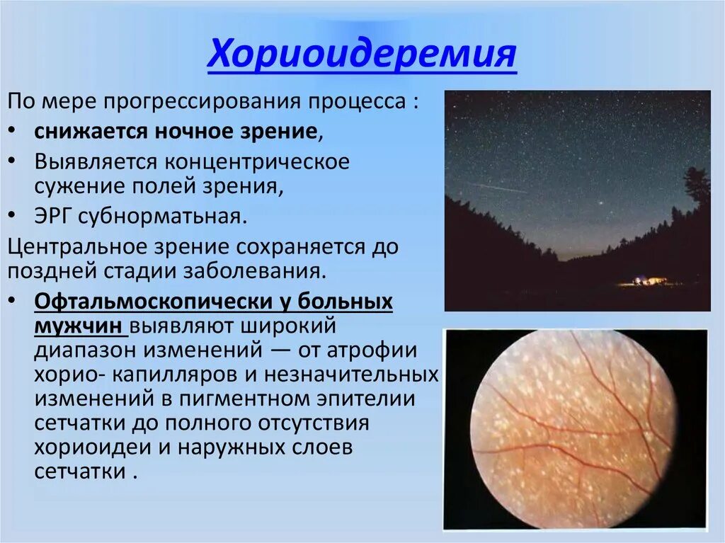 Заболевания сосудистой оболочки. Дольчатая атрофия хориоидеи. Перипапиллярная атрофия хориоидеи.