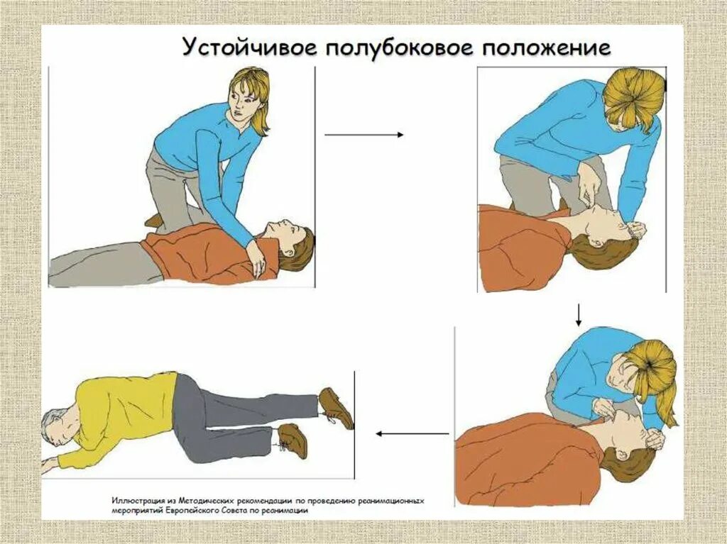 Оказание первой помощи при слр. Базовая сердечно-легочная реанимация алгоритм. Алгоритм 1 помощи при сердечно легочной реанимации. СЛР этапы проведения сердечно-легочной реанимации. Алгоритм проведения базовой сердечно-легочной реанимации картинки.