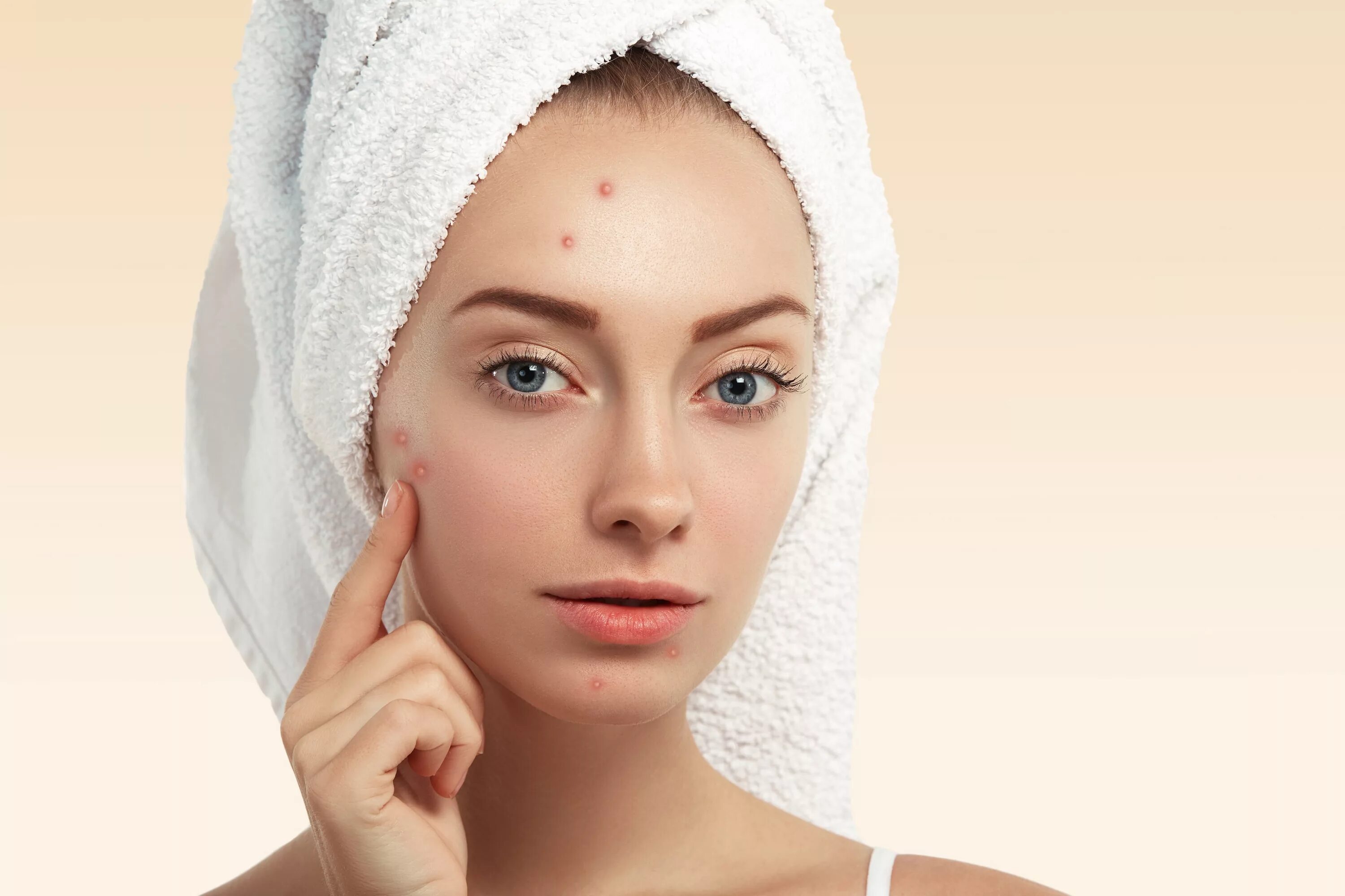 Проблемная девочка. Лицо девушки с проблемной кожей. Девушка с проблемной кожей. Девушка недовольна своей кожей. Девушка с проблемной кожей.