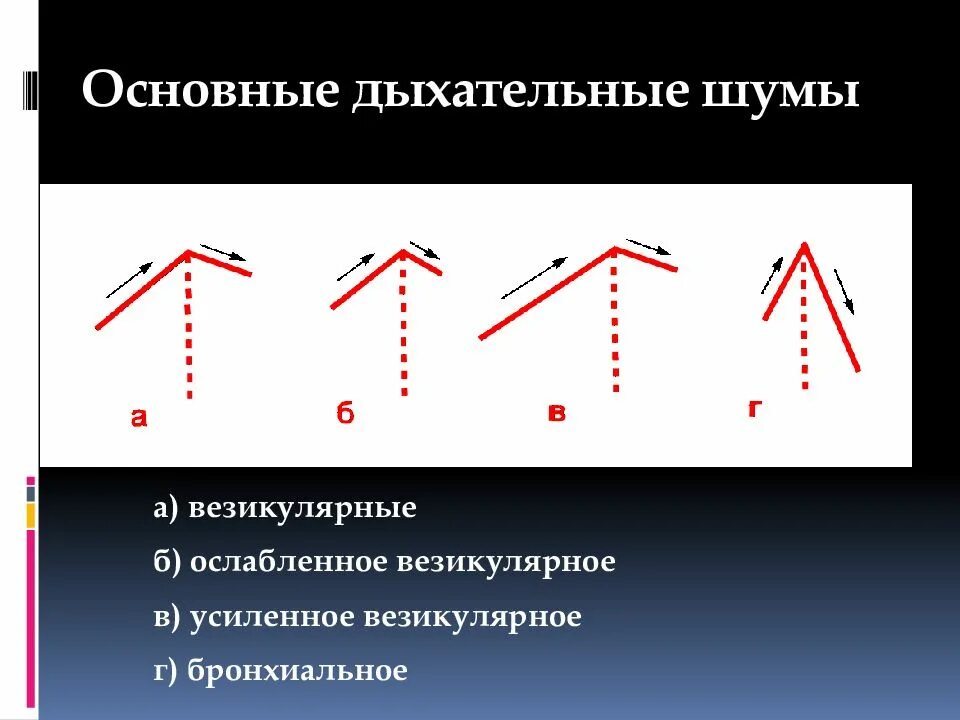 Основные дыхательные шумы Графическое изображение. Основные и дополнительные дыхательные шумы. Схемы побочных дыхательных шумов. Дополнительные дыхательные шумы схема. Жесткое везикулярное дыхание