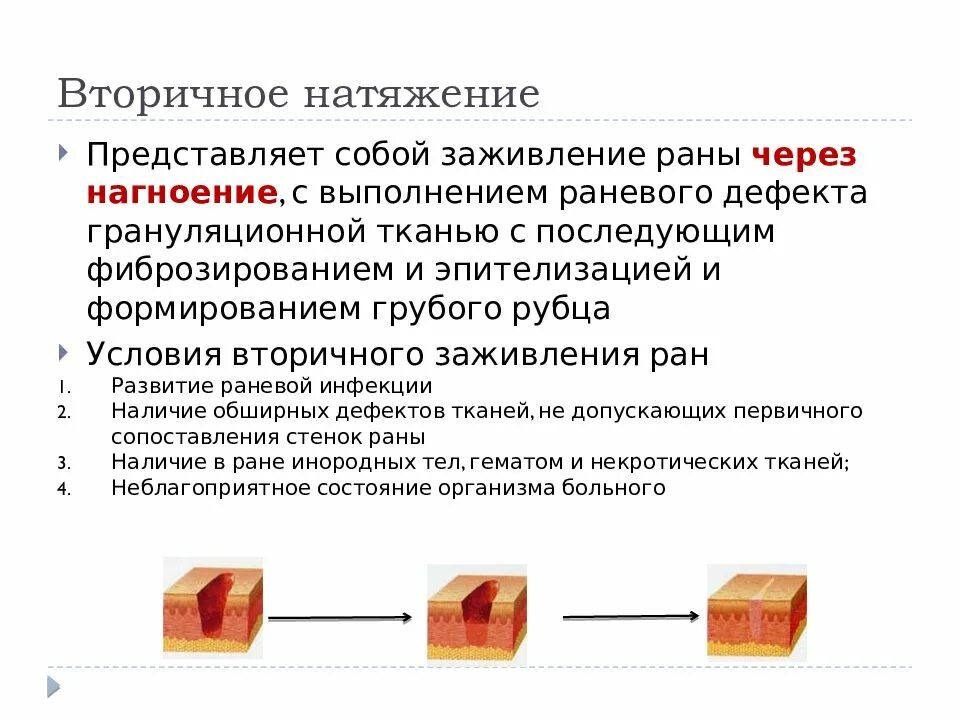 Через сколько заживает рана. Заживление РАН вторичным натяжением. Этапы вторичного заживления РАН. Вторичное натяжение раны. Первичное натяжение раны.