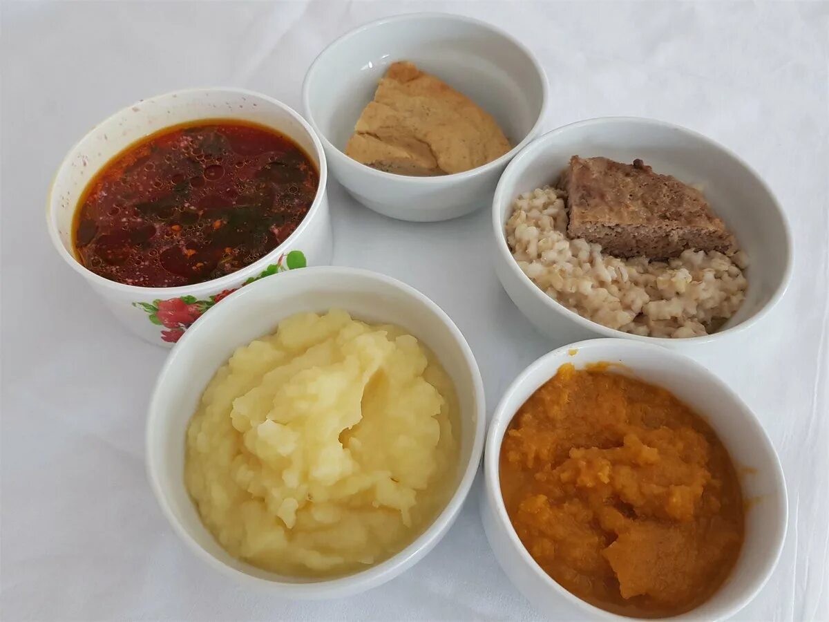 диета при мононуклеозе у детей 6 лет. диета после мононуклеоза у детей. диета при желтухе. цирроз гепатит дифференциальный диагноз. надпеченочная желтуха таблица.