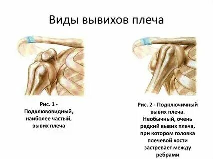 Не поднимается рука причина