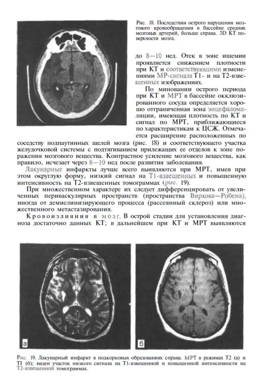 Онмк в бассейне сма