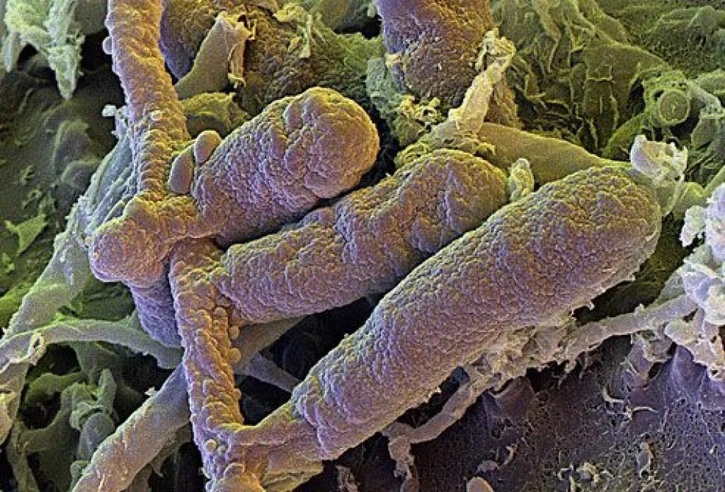 грибы микроорганизмы кандиды. рисунки возбудителей грибковых инфекций. возбудители плесневых микозов. возбудители грибковых кишечных, респираторных инфекций. возбудители грибковых кишечных инфекций микотоксикозов.