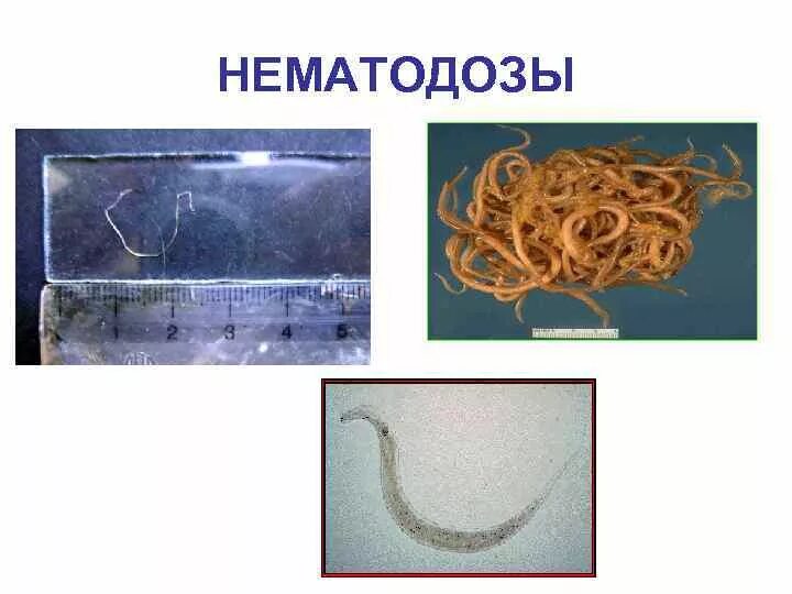 Круглые черви нематоды паразиты. Нематоды - Первичнополостные черви. Черви паразиты человека нематоды. Круглые гельминты,нематоды. Круглые черви заболевания