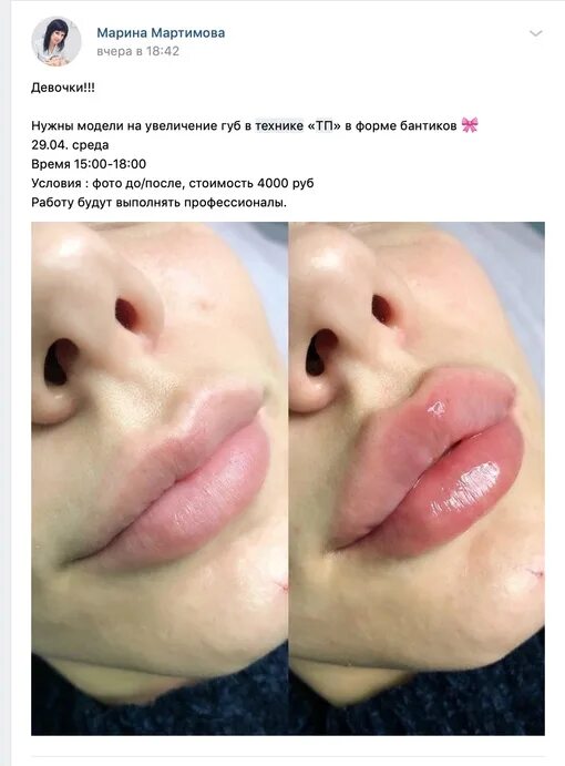Как переводить тп