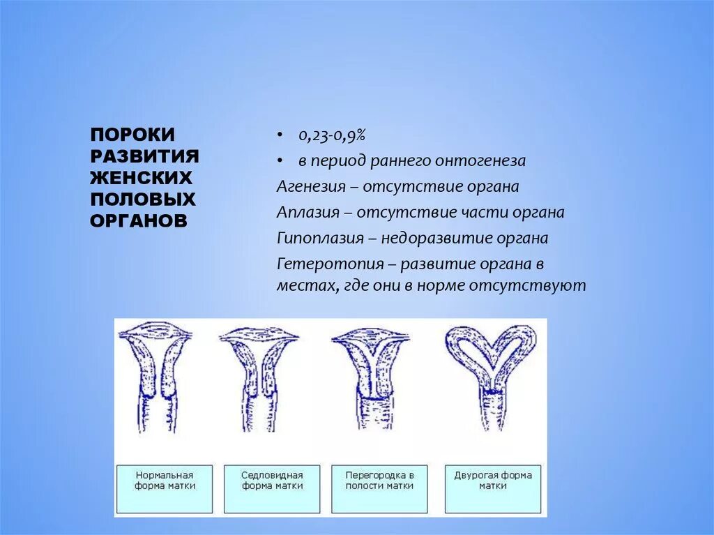 Недоразвитая матка у мужчин. Седловидная аномалия матки. Пороки развития женских органов. Аномалии развития женских половых органов. Аномалия развития женских репродуктивных органов.