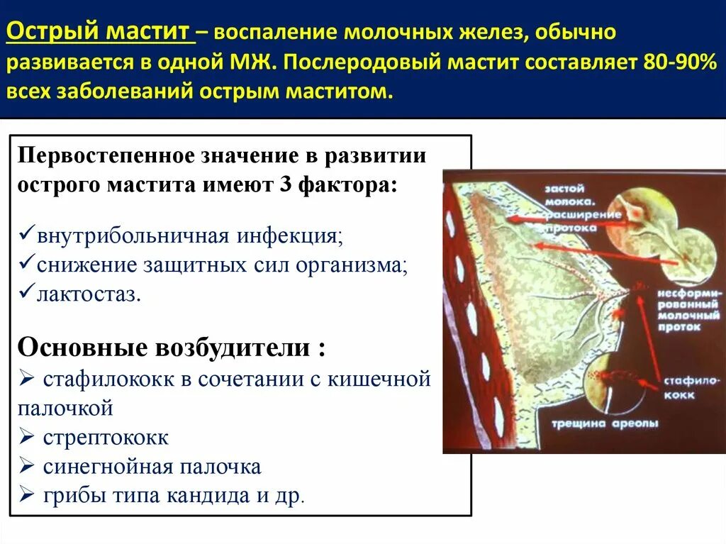 Мастит клинические проявления. Болезни молочной железы. Мастит воспаление молочной железы.