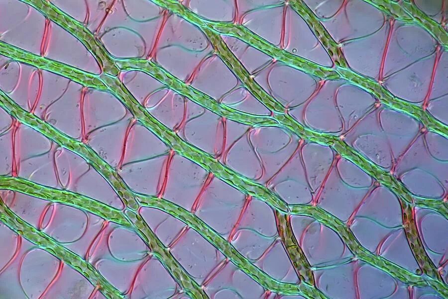 Водоносные клетки в листьях имеет. Мох сфагнум клетки листа под микроскопом строение. Мох сфагнум клетки листа под микроскопом. Водоносная ткань сфагнума. Строение листа мха сфагнума.