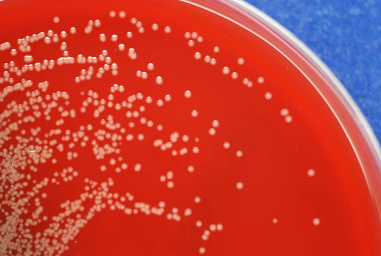 Enterobacter cloacae что это
