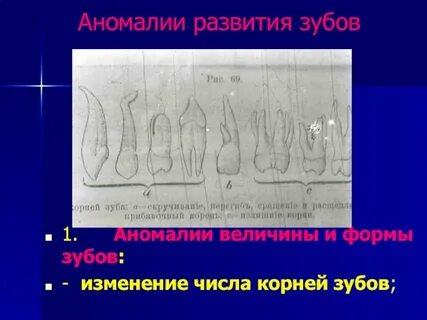 Аномалия количества