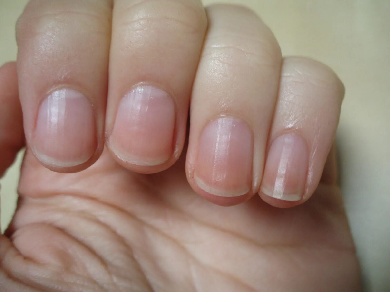 Мужской маникюр. Поперечная исчерченность ногтей. Типы ладоней и пальцев. Какого цвета должны быть руки. Линия симиан синдром дауна.