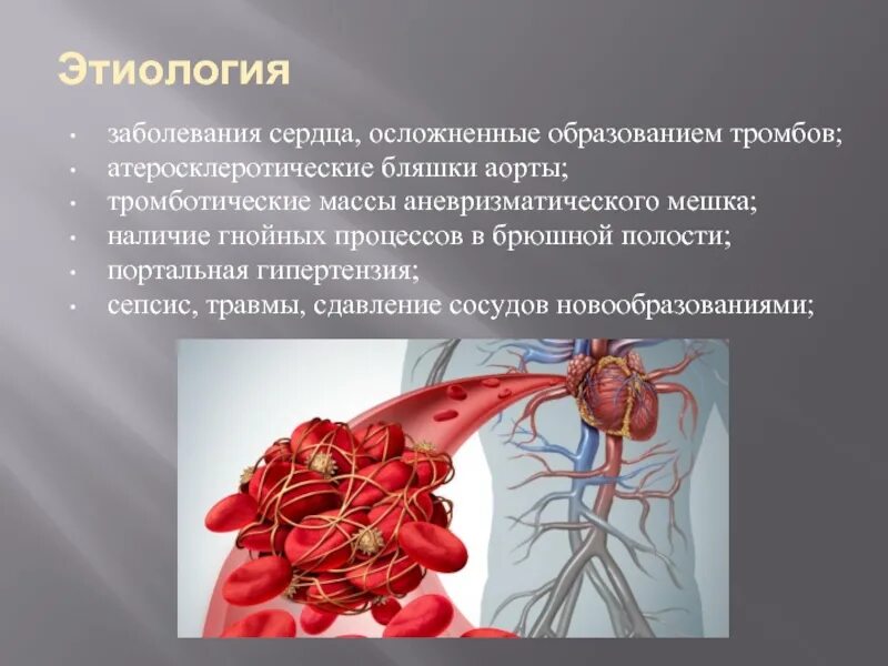 Заболевание сосудов называется. Мезентериальный тромбоз клиника. Образование тромба в сердце. Тромбоз в полостях сердца.