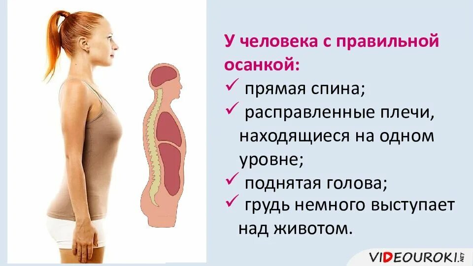 Профилактика плоскостопия биология 8 класс. Плоскостопие неправильная осанка. Причины нарушения плоскостопия. Плоскостопие вид сзади. Правильная осанка.