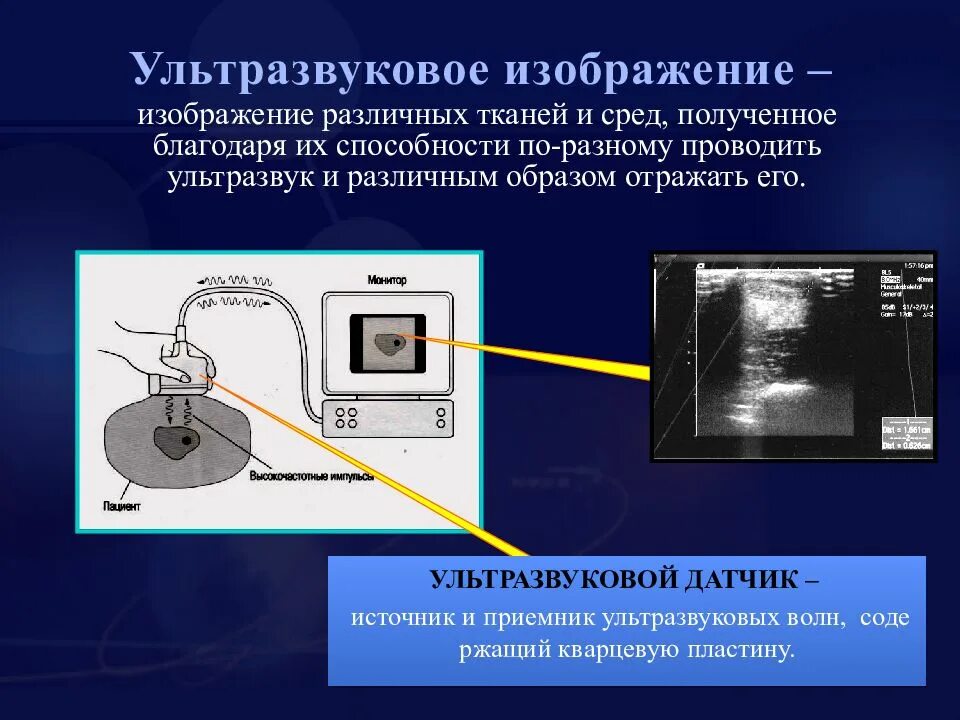 Продольные ультразвуковые волны. УЗИ отражение ультразвука датчик. Принцип получения ультразвукового изображения. Ультразвуковые волны в медицине. Ультразвук изображение.