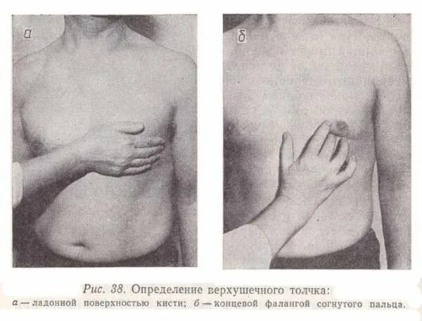 Верхушечный толчок при гипертрофии. Методика пальпации верхушечного толчка. пальпация области сердца верхушечный толчок. пальпация области сердца пропедевтика. методика пальпации сердечного толчка.