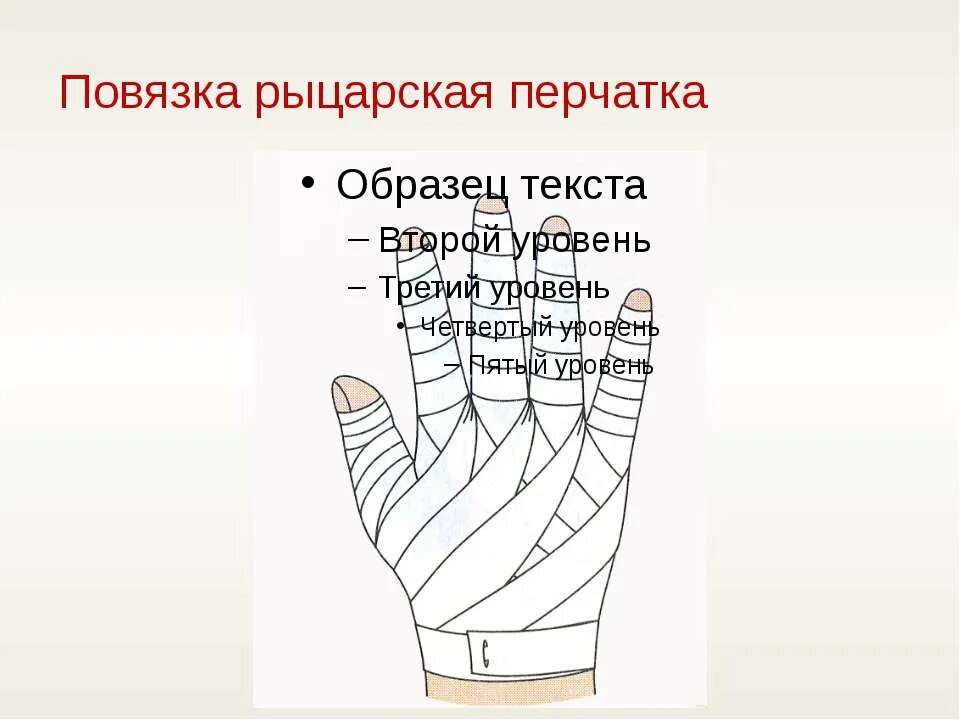 Техника наложения повязки перчатка. Рыцарская перчатка повязка. Рыцарская перчатка перевязка. "Рыцарская перчатка" алгаритм наложения. Рыцарская перчатка повязка алгоритм наложения.