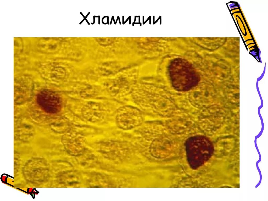Хламидии песня слушать. Хламидии микробиология. Хламидии морфология. Хламидии строение микробиология.