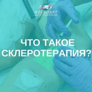 Флебоарт