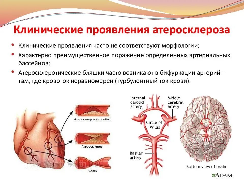 Клинические симптомы атеросклероза. Основные клинические симптомы атеросклероза. Атеросклероз причины клинические проявления. Клинические проявления атеросклероза в зависимости от локализации.