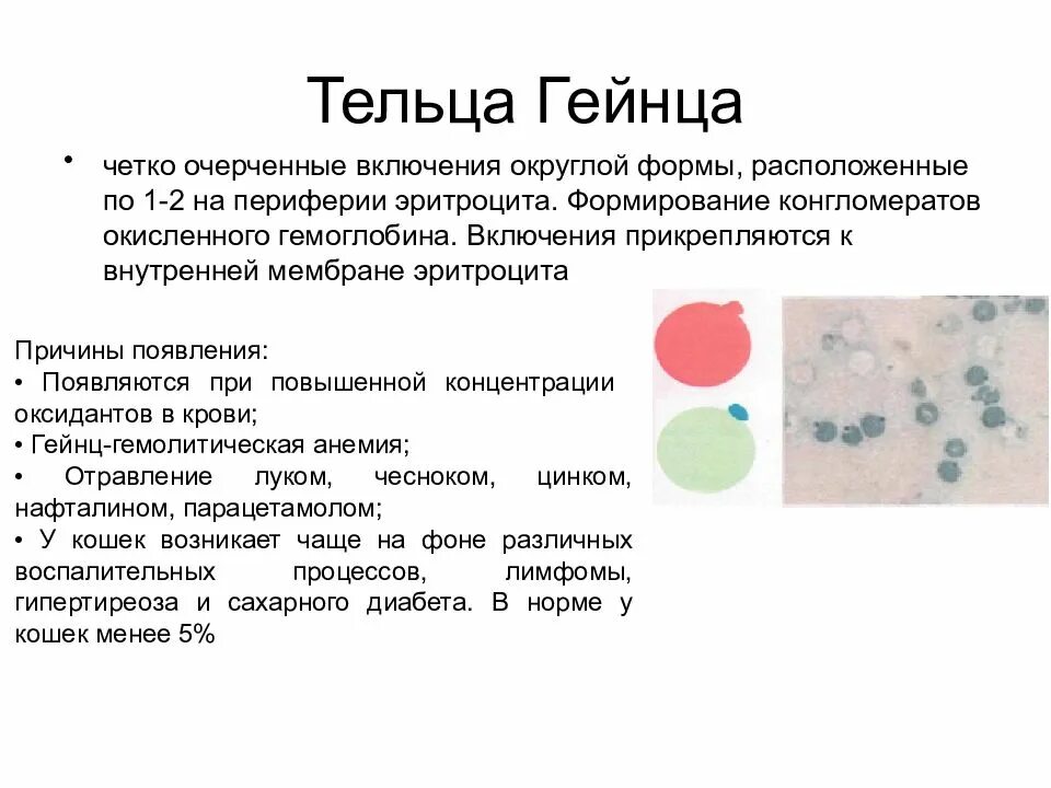 Тельца в эритроцитах. Сидерозные (железосодержащие) гранулы эритроцитов. Тельца жолли и кольца кебота. Включения в эритроцитах тельца жолли. Тельца в эритроцитах.