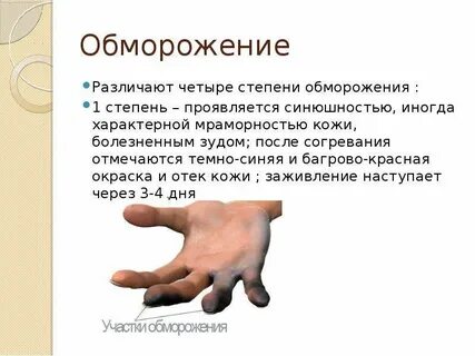 Iv степени