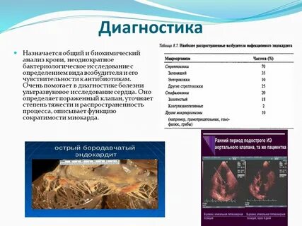Эндокардит возбудители