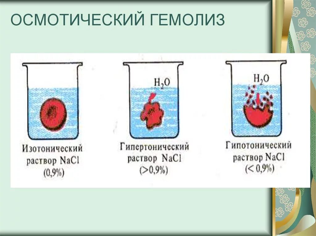 Осмотический гемолиз эритроцитов. Гемолиз эритроцитов в гипертоническом растворе. Гипоосмотический Гемолдиз. Гипертонический раствор эритроциты.